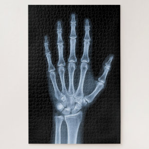 Clinical X-Ray Hand Jigsaw Puzzle