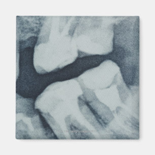 Close-up of a dental X-Ray Magnet