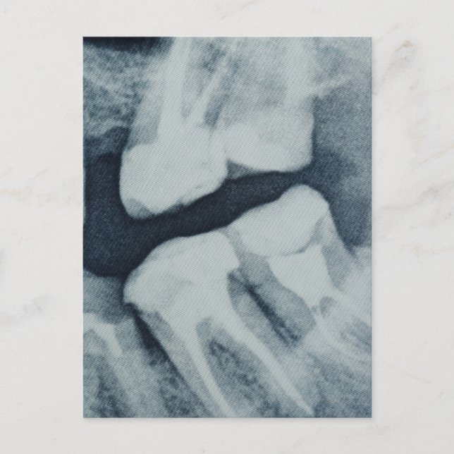 Close-up of a dental X-Ray Postcard (Front)