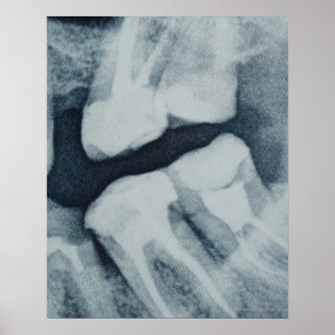Close-up of a dental X-Ray Poster