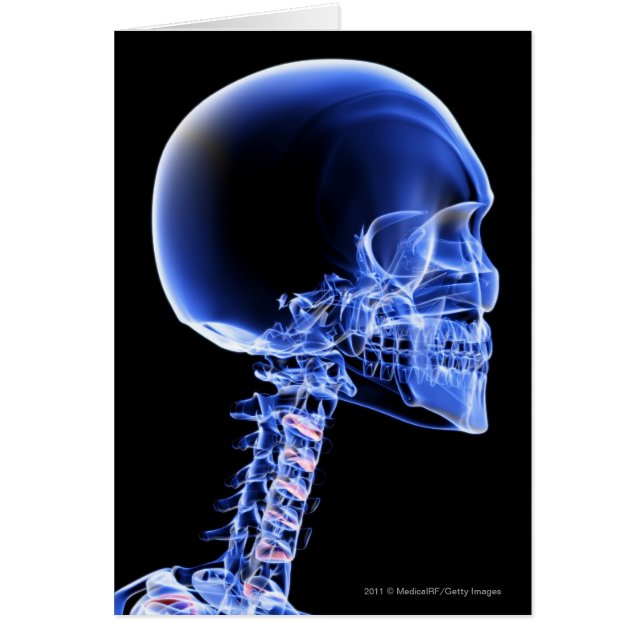 Close up x-ray of the bones in the neck (Front)