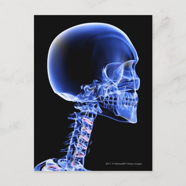 Close up x-ray of the bones in the neck postcard (Front)