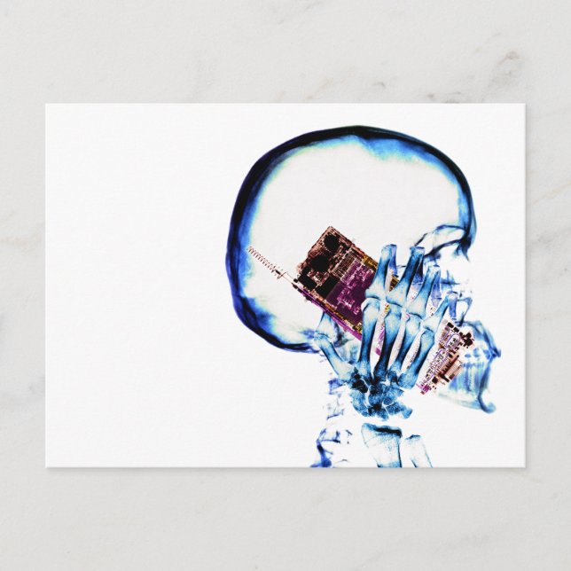 Colour X-Ray Vision Skeleton Skull Cell Phone Postcard (Front)