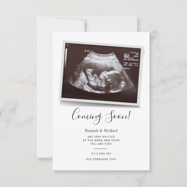 Coming Soon Script Sonogram Pregnancy Announcement (Front)