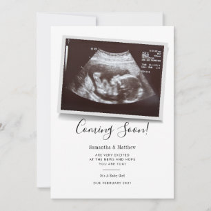 Coming Soon Script Ultrasound Sonogram Pregnancy Announcement