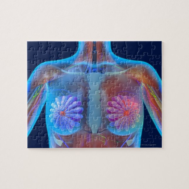 Computer artwork representing breast cancer, jigsaw puzzle (Horizontal)