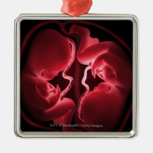Conceptual image of a womb containing twins metal tree decoration