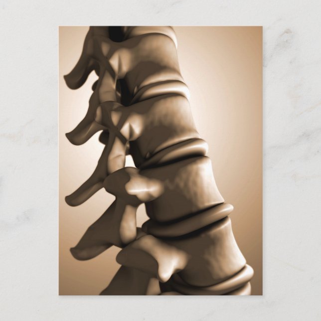Conceptual Image Of Human Backbone 4 Postcard (Front)