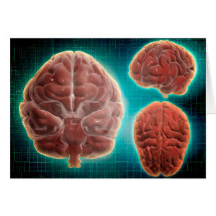 Conceptual Image Of Human Brain At Different