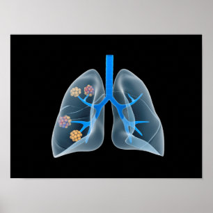 Conceptual Image Of Human Heart 4 Poster