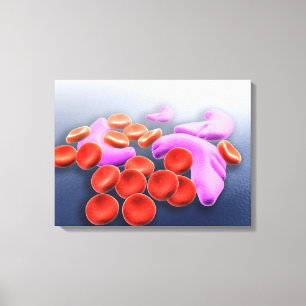 Conceptual Image Of Sickle Cell Anaemia Canvas Print