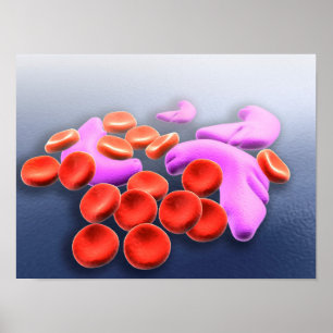 Conceptual Image Of Sickle Cell Anaemia Poster