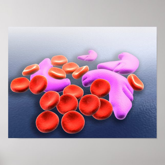 Conceptual Image Of Sickle Cell Anaemia Poster (Front)