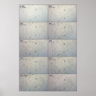 Confluence follow-up Chart