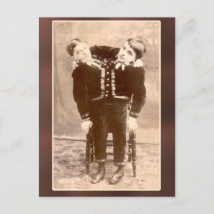 Conjoined Twins Vintage Cards and Postcards