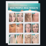 Consumer Sell Sheet – Real People, Real Results<br><div class="desc">A two-page snapshot of Ayucell’s skincare approach,  results,  and retail potential. Perfect for sharing with curious customers or prospects,  this sheet highlights clinical findings,  real user feedback,  and why beauty businesses are choosing Ayucell.</div>