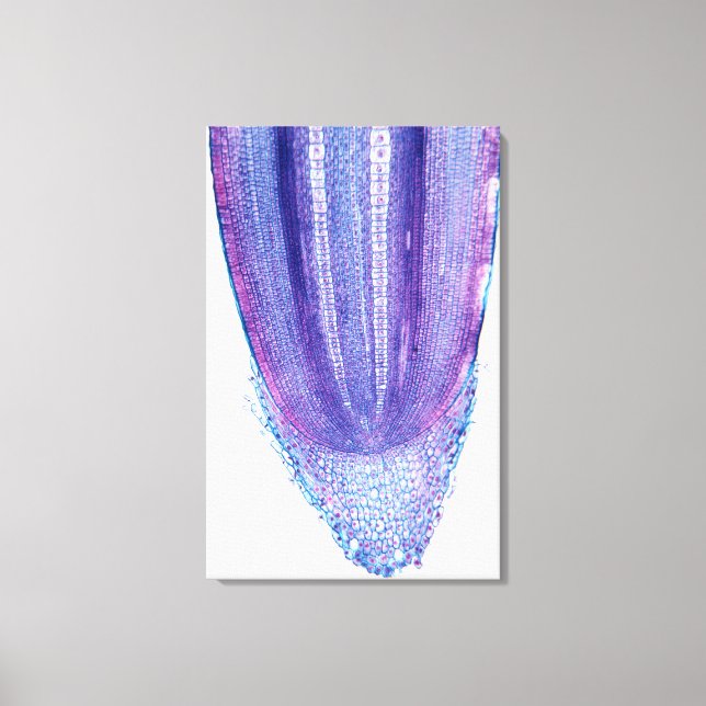 Corn Plant Root Tip Canvas Print (Front)