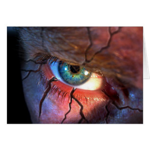 Cracked Eye