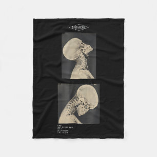 Cropped Headbanger X-Ray Doctors Fleece Blanket