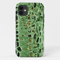 Cross Section of Leaf