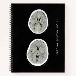 CT Scan_CTFOD_ This is what depression looks like Notebook