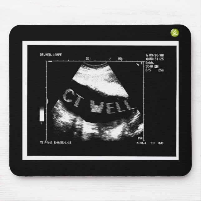 CT Well Mousepade (CT Well in the belly) Mouse Mat (Front)