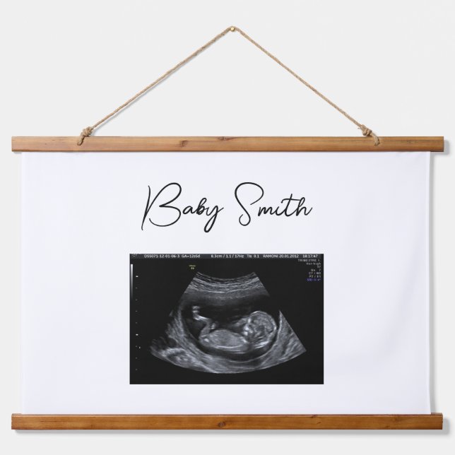 Custom Baby Sonogram Ultrasound Wood Topped Hanging Tapestry (Front)