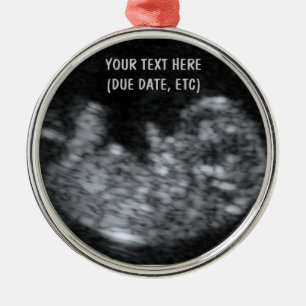 Custom Baby Ultrasound Photo Metal Tree Decoration