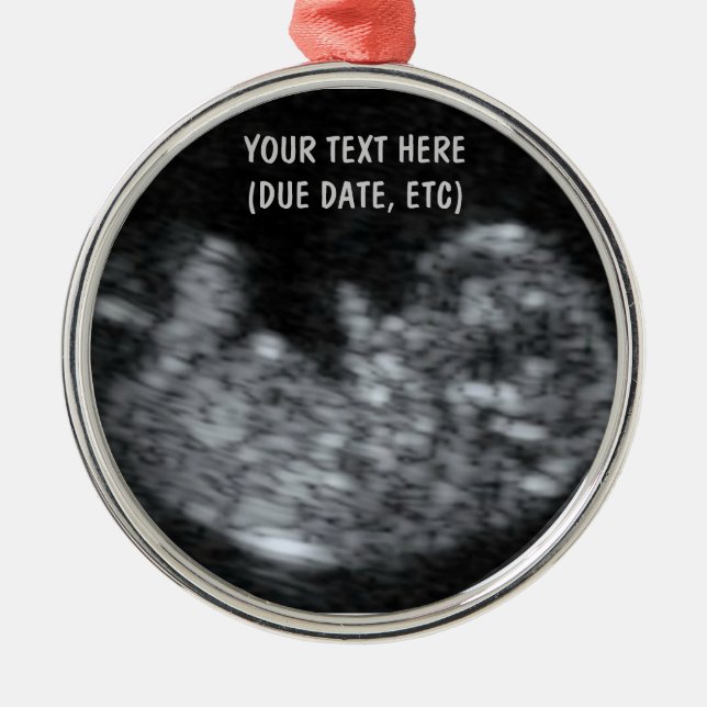 Custom Baby Ultrasound Photo Metal Tree Decoration (Front)