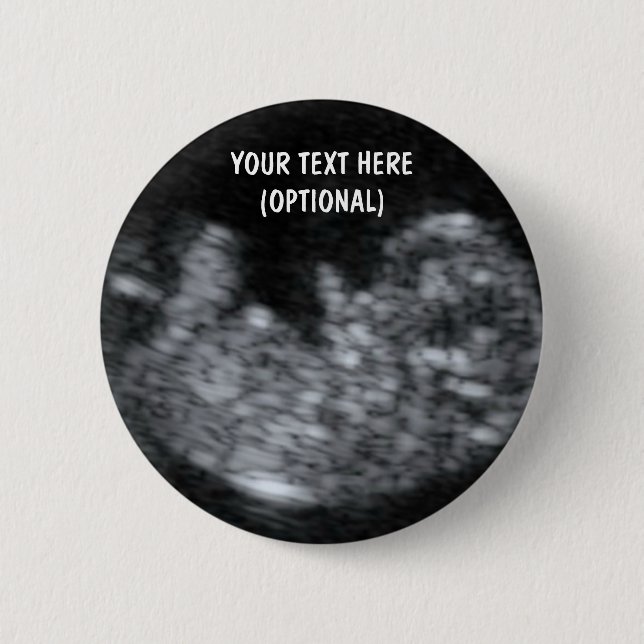 Custom Baby Ultrasound Picture 6 Cm Round Badge (Front)