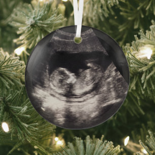 Custom Baby Ultrasound Pregnancy Announcment Photo Glass Tree Decoration
