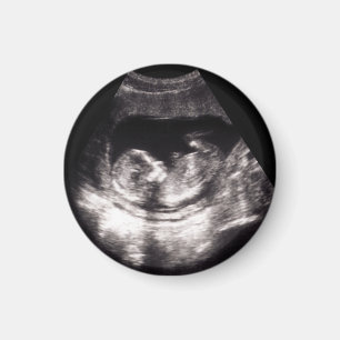 Custom Baby Ultrasound Pregnancy Announcment Photo Magnet