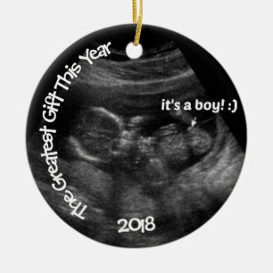 Custom EASY Ultrasound Template Ceramic Tree Decoration