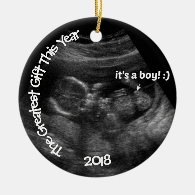 Custom EASY Ultrasound Template Ceramic Tree Decoration (Front)