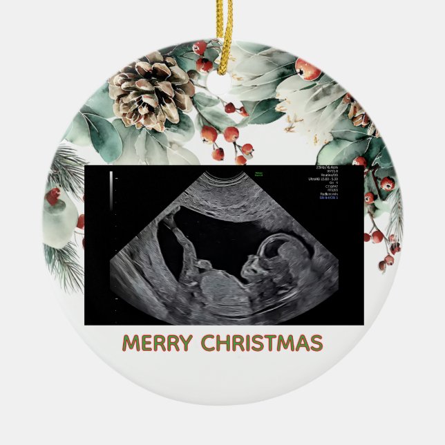 Custom First Christmas Expecting Photo Ornament (Front)