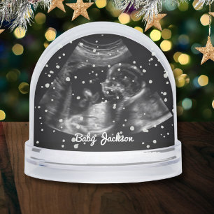 Custom Sonogram Pregnancy Ultrasound Photo Snowglobe