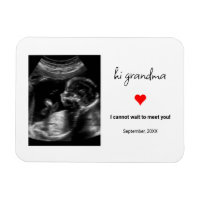 Custom Ultrasound Photo Gift For Grandma, Grandpa