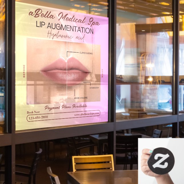 Customise Med Spa Lip Augmentation Hyaluronic Fill Window Cling (Restaurant Window)