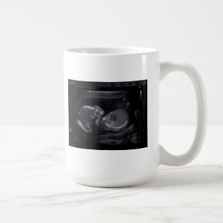 Customised Ultrasound Mug