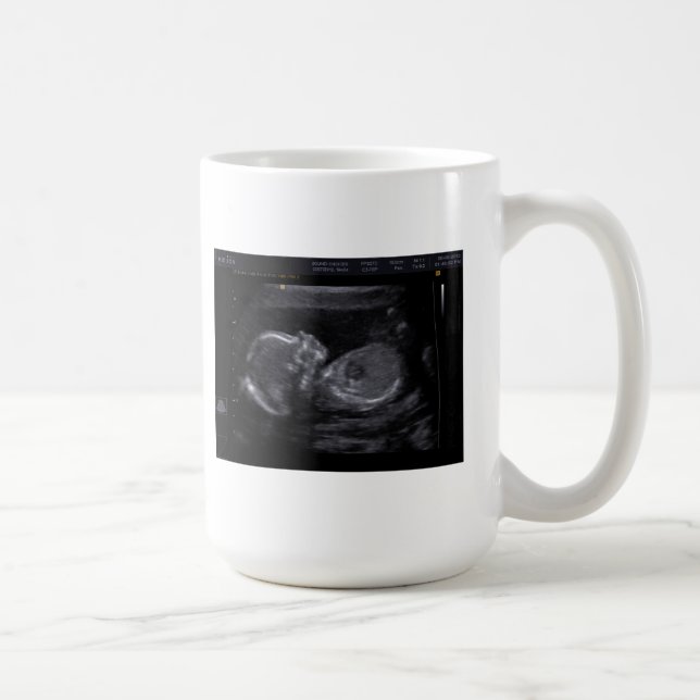 Customised Ultrasound Mug (Right)