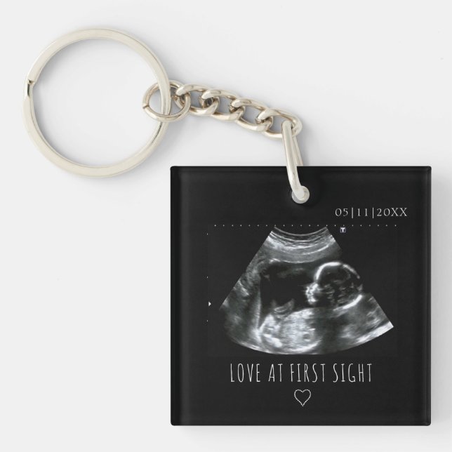 Cute Ultrasound Picture Gift Sonogram Key Ring (Front)