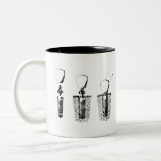 Dental implant procedure Two-Tone coffee mug