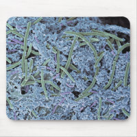 Dental plaque, coloured scanning electron