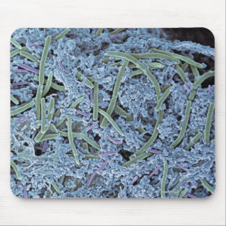 Dental plaque, coloured scanning electron mouse mat