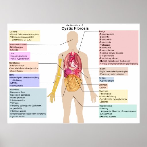 shop unique gifts of  Fibrosis Cystic Chart  Zazzle Symptoms Poster Detailed the of