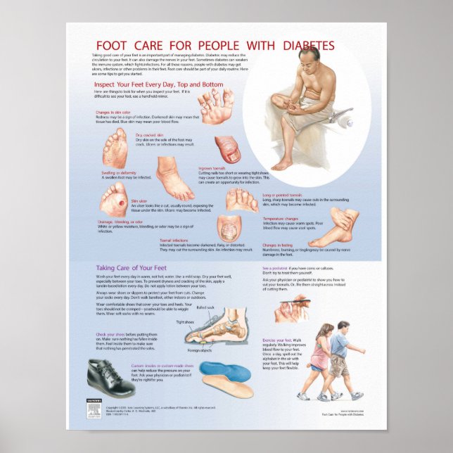 Diabetes Foot Care Poster - Netter Chart (Front)