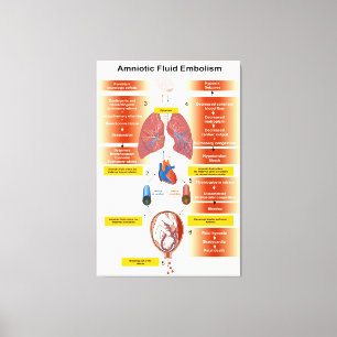 Diagram of an Amniotic Fluid Embolism AFE Canvas Print