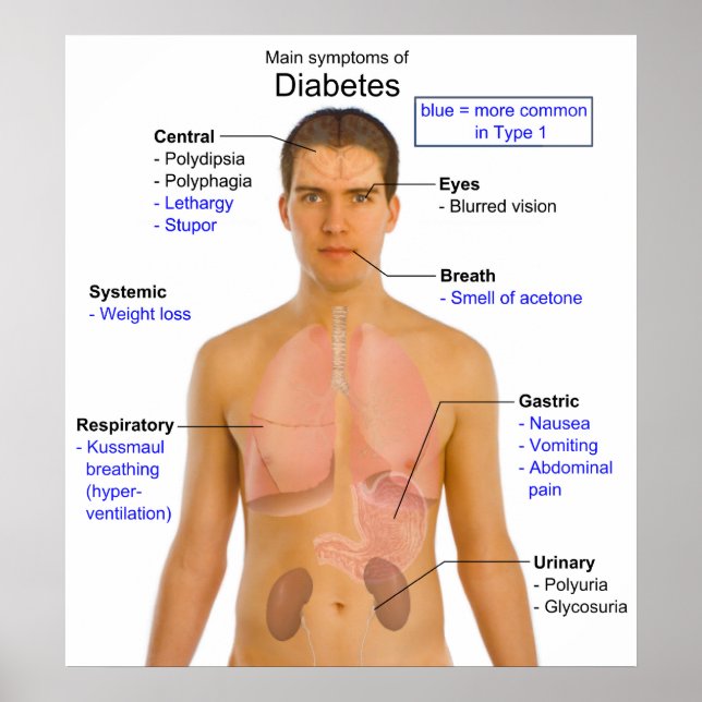Diagram of the Main Symptoms of Diabetes in Humans Poster (Front)