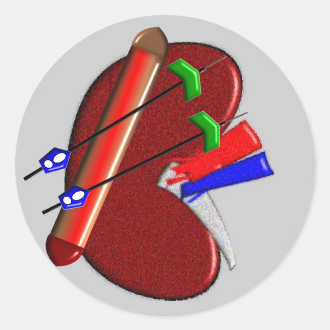 Dialysis  And Kidney Design Gifts Classic Round Sticker (Front)
