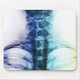 Digital Cervical X-Ray Art Mouse Mat
